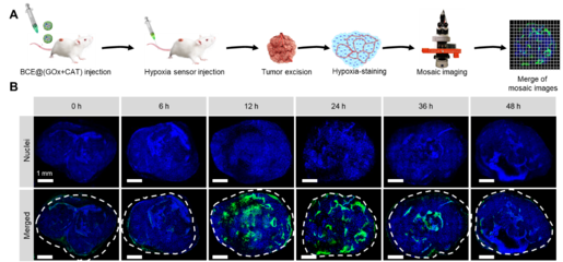 中國科學技術(shù)大學王育才教授:納米級聯(lián)簇化酶用于腫瘤葡萄糖耗竭治療